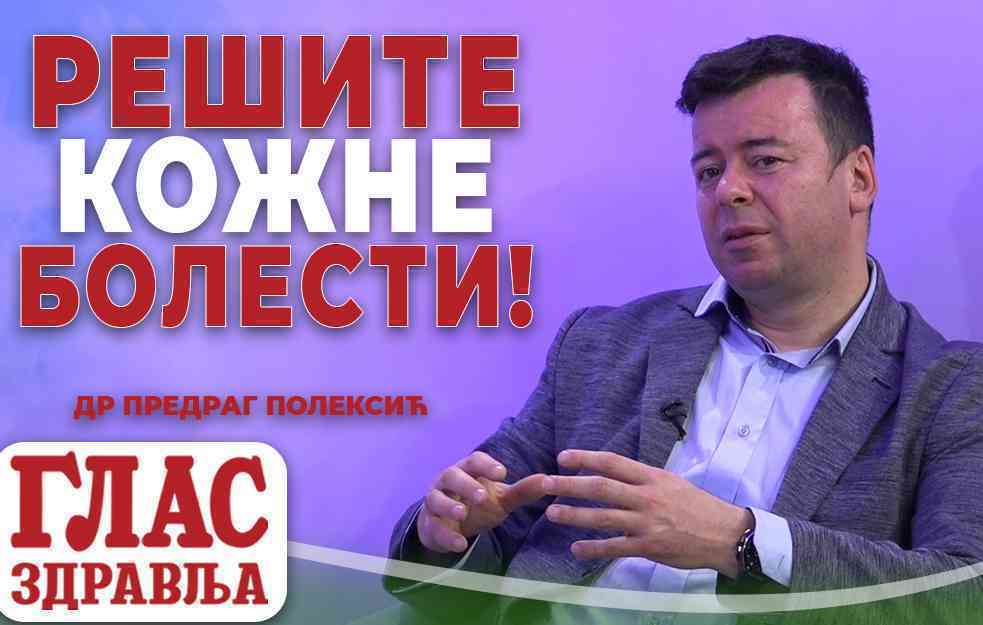 KAKO SE REŠITI ALOPECIJE, AKNI, OŽILJAKA I SUMNJIVIH MLADEŽA! OVO JE NAČIN! DR PREDRAG POLEKSIĆ (VIDEO)